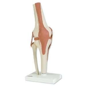 3B Scientific A82 Functional Knee Joint Model, 4.7 x 4.7 x 13.4 