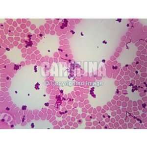 Bacteria, Yeast, and Blood, w.m., Microscope Slide:  