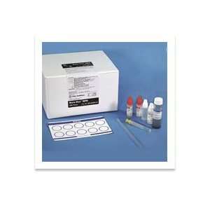    RPR Rapid Test Kit for Syphilis (500 test kit) 