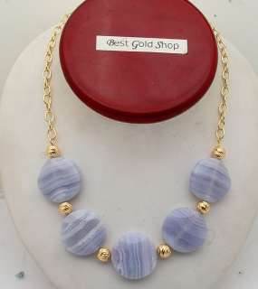 Technibond Blue Lace Agate Necklace Sterling Silver  