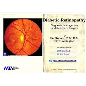 com Diabetic Retinopathy Diagnosis, Management and Reference Images 
