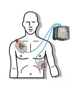 Philips HeartStart OnSite AED Defibrillator  